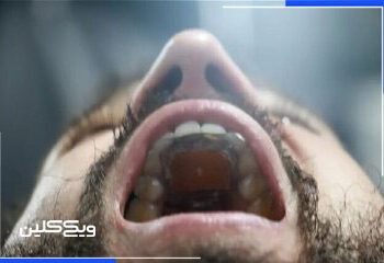 دستگاهی برای کنترل گوشی با زبان